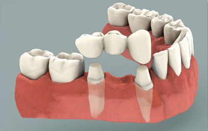 Profilaxie orala - Artistic Dent